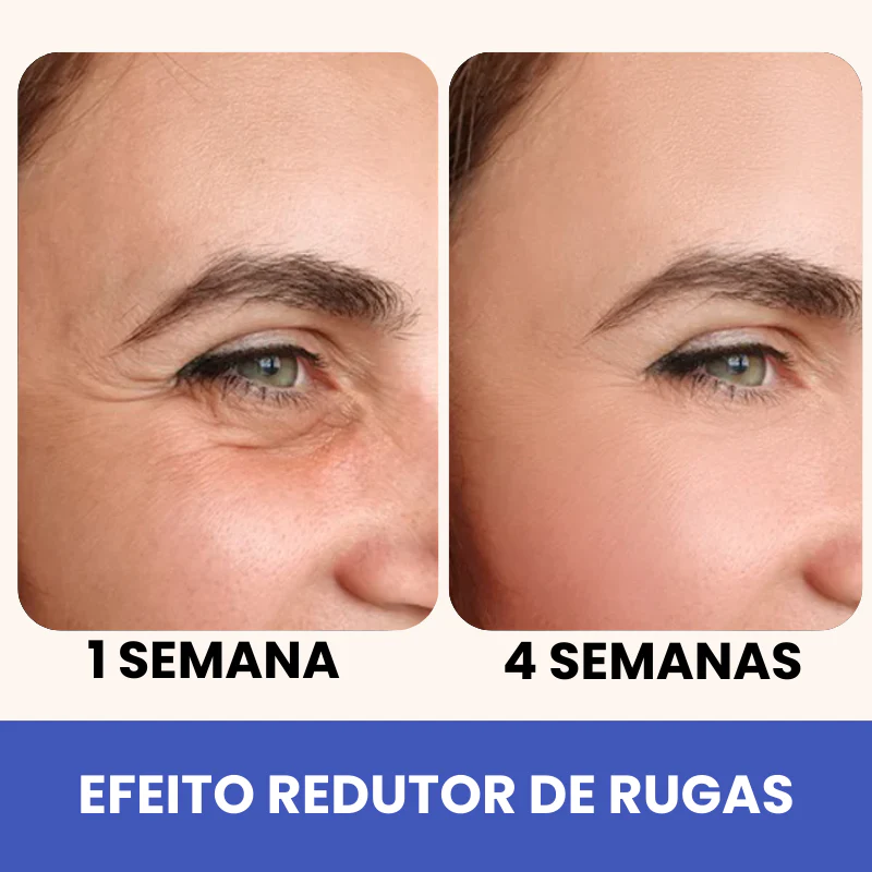 Eleva 10 em 1 - Pálpebra, Bolsas e Rugas - Image 5